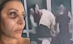 Sitede kadına taciz iddiası! Eşiyle birlikte saldırdı