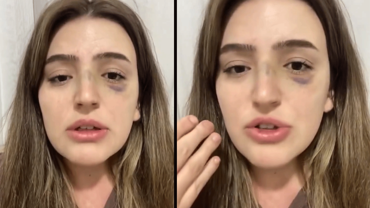 Teğmen eşinin şiddetine uğrayan Zeynep'in yardım çığlığı!